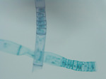MISSING THUMBNAIL